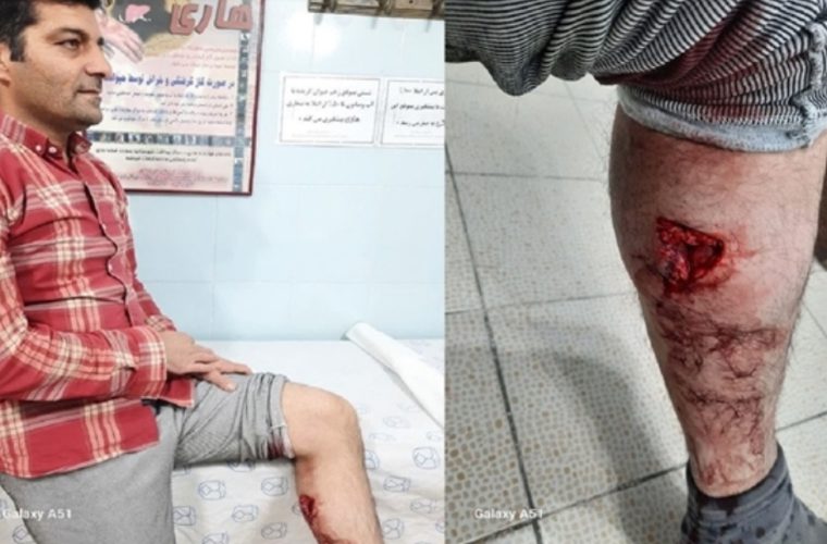 مصدومیت شدید واکسیناتور شبکه دامپزشکی شهرستان مبارکه بر اثر حمله یک قلاده سگ گله