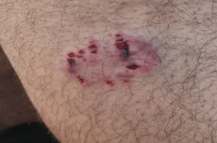 حمله سگ نگهبان به کارشناس شبکه دامپزشکی شهرستان گلپایگان